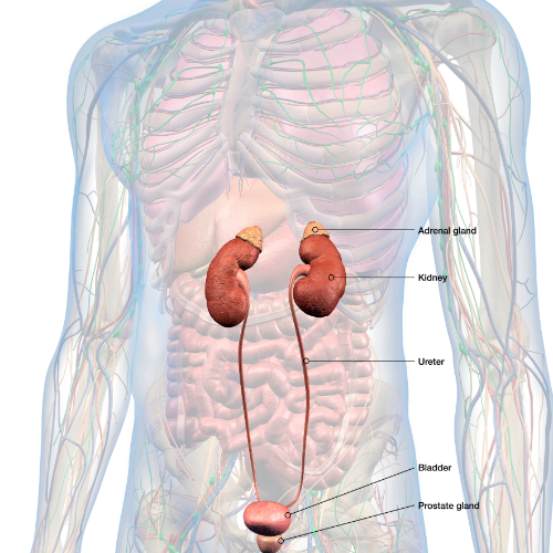cálculos renales o piedras en el riñón